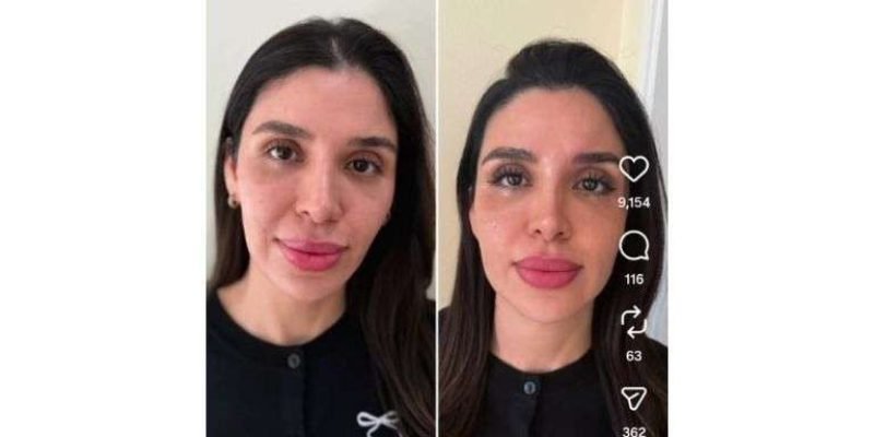 emma-coronel-nuevo-look-tratamiento-estetico